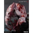 Silent Hill f Estatua Resina 1/6 Kashimashi 23 cm